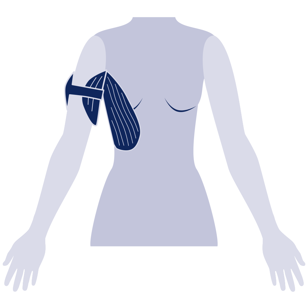Axilla Pad